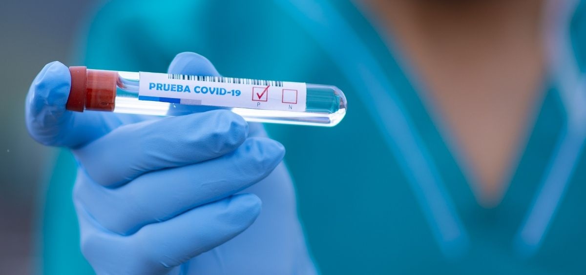 20201106 CRIBADO COVID-19